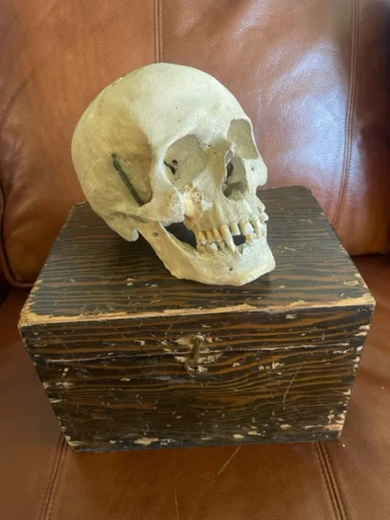 Antique Human Skull With Possible Pathology