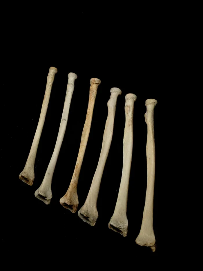 Set Of 6 Medically Lightened Human Radius Bones For Sale