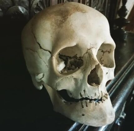 Real uncut human skull with small trepination scars