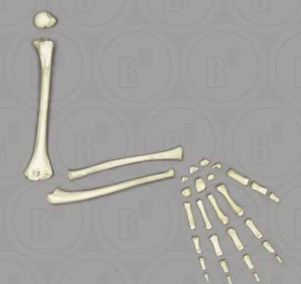 Human Child 6-year-old Arm, Disarticulated without Scapula