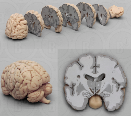 Human Brain Multiple Coronal Sections