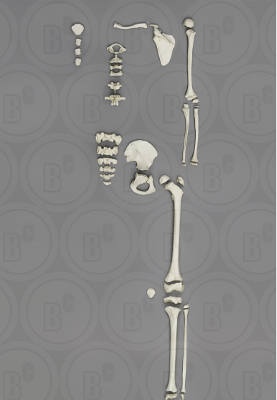 Human Male 13-year-old European American Partial Skeleton