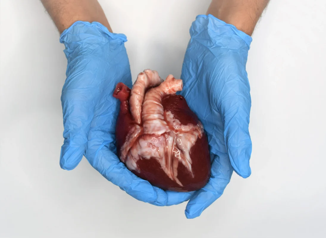 Heart Transplants vs. Buying a Heart: What’s the Difference?