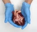 Heart Transplants vs. Buying a Heart: What’s the Difference?